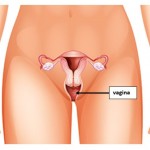 Vagina C