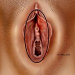 Vaginal vestibule