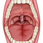 Uvula A