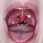 Uvula B