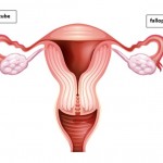 Fallopian tube